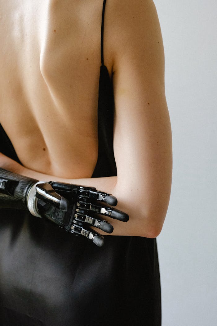 Stylish woman with a prosthetic arm in a black dress, showing empowerment and technology